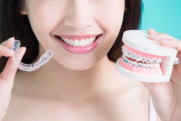 Are Braces Worth It? Why You Need To Get Braces?